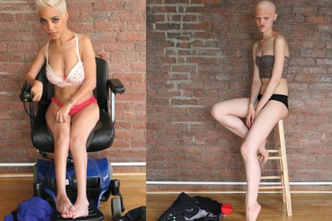 Γυναίκες με σωματικές δυσπλασίες, βγάζουν τα ρούχα τους για ένα απίθανο project!  - Κεντρική Εικόνα