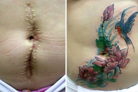 Αυτή η γυναίκα κάνει δωρεάν τατουάζ πάνω σε σημάδια ενδοοικογενειακής βίας 