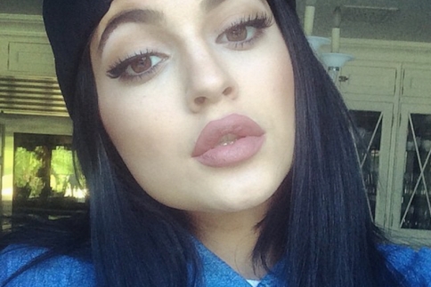 Κylie Jenner: Τα χείλη της είναι η νέα εμμονή στα social media (Videos)
