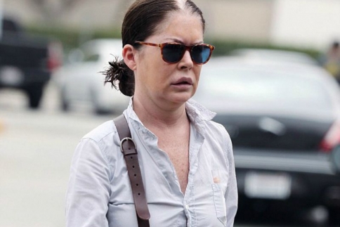 Lara Flynn Boyle: Παραμορφώθηκε από τις πλαστικές 