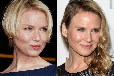 Ντελίριο των media με τις πλαστικές της Renee Zellweger! Δες πως άλλαξε το πρόσωπό της από κάθε γωνία