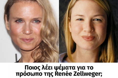 Ποιός λέει αλήθεια για το πρόσωπο της Renee Zellweger