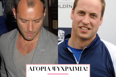 Τριχόπτωση; Και οι celebrities έχουν τα προβλήματά τους