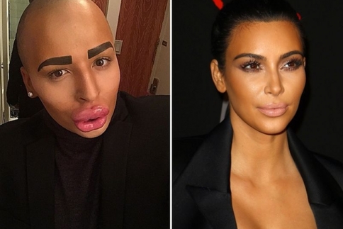 Άντρας πλήρωσε εκατοντάδες χιλιάδες δολάρια για να μοιάσει στην Kim Kardashian