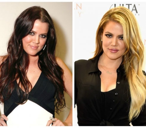 Khloe Kardashian : Το πριν και μετά τις πλαστικές