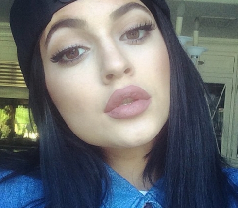 Κylie Jenner: Τα χείλη της είναι η νέα εμμονή στα social media (Videos)
