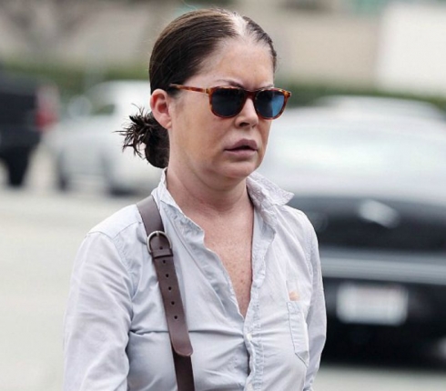Lara Flynn Boyle: Παραμορφώθηκε από τις πλαστικές 