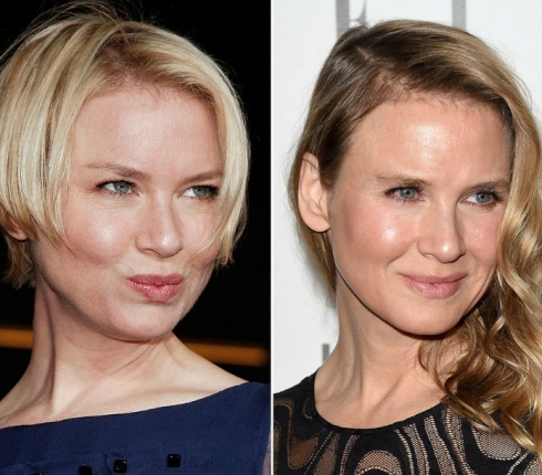 Ντελίριο των media με τις πλαστικές της Renee Zellweger! Δες πως άλλαξε το πρόσωπό της από κάθε γωνία