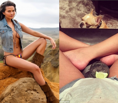 Chrissy Teigen: Και όμως έχει ραγάδες!
