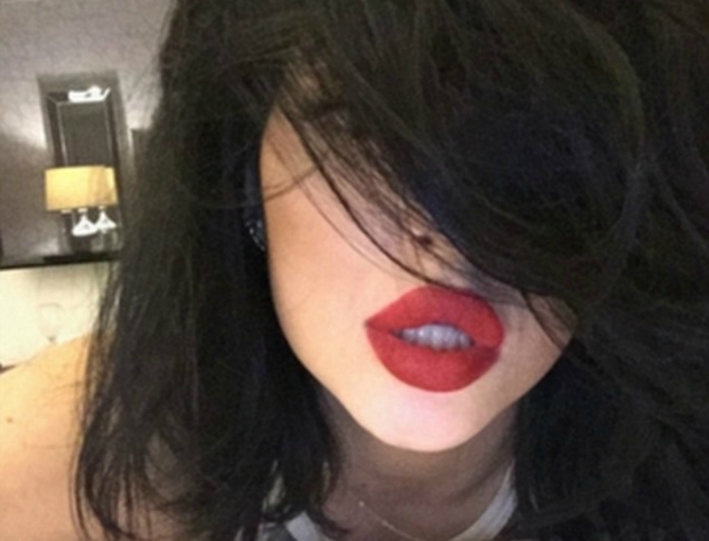 Τα χείλη της Kylie Jenner προκάλεσαν χαμό στο Twitter