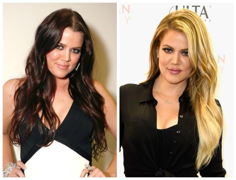 Khloe Kardashian : Το πριν και μετά τις πλαστικές