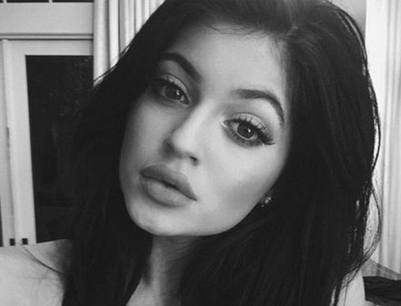 Kylie Jenner δεν πείθεις κανέναν! Τι λέει για τα φουσκωμένα χείλη 