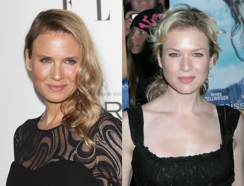 Ποιο νυστέρι; Η Renee Zellweger διαψεύδει τους πάντες!