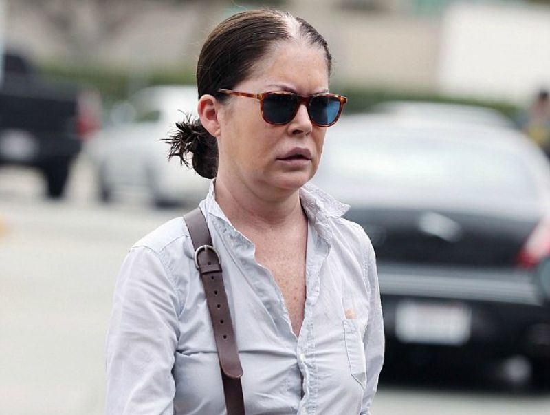 Lara Flynn Boyle: Παραμορφώθηκε από τις πλαστικές 