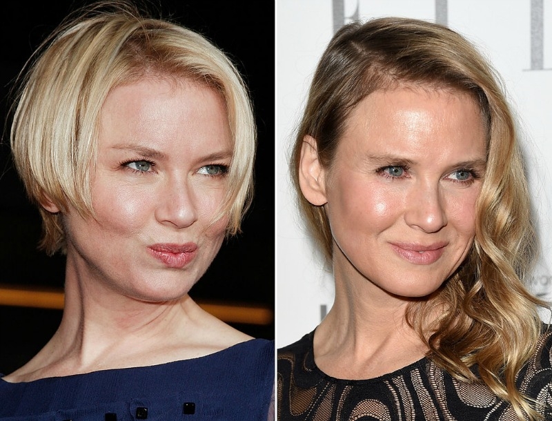 Ντελίριο των media με τις πλαστικές της Renee Zellweger! Δες πως άλλαξε το πρόσωπό της από κάθε γωνία