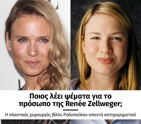 Ποιός λέει αλήθεια για το πρόσωπο της Renee Zellweger