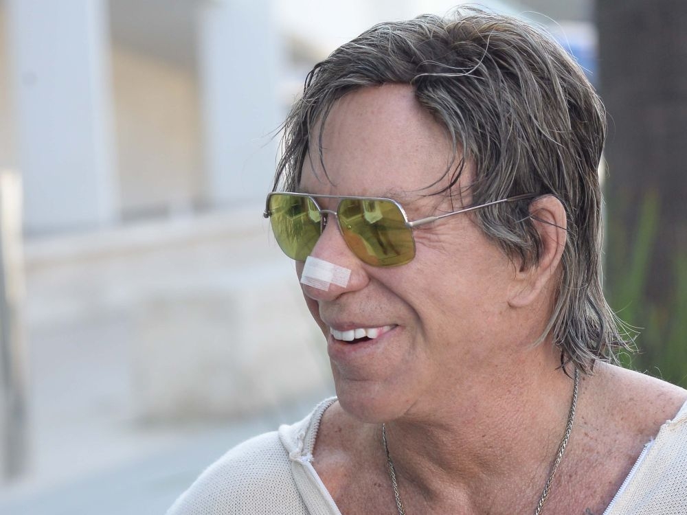 Mickey Rourke τι έπαθες;