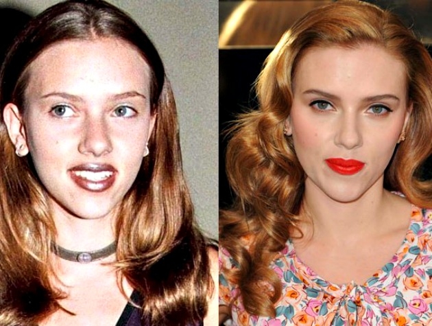 Δεν είναι μόνο η Renee Zellweger αγνώριστη: Διάσημοι πριν και μετά την πλαστική