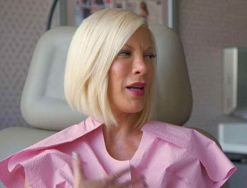 To δράμα της Tori Spelling! Xρειάζεται νέα προσθετική στήθους…