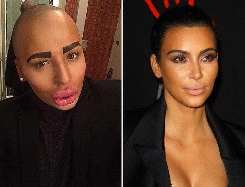 Άντρας πλήρωσε εκατοντάδες χιλιάδες δολάρια για να μοιάσει στην Kim Kardashian